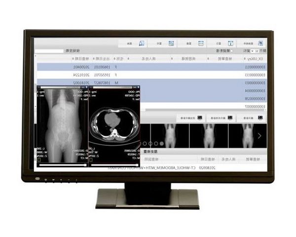 Monitor médico Full HD de grado médico para radiología e imágenes ópticas.